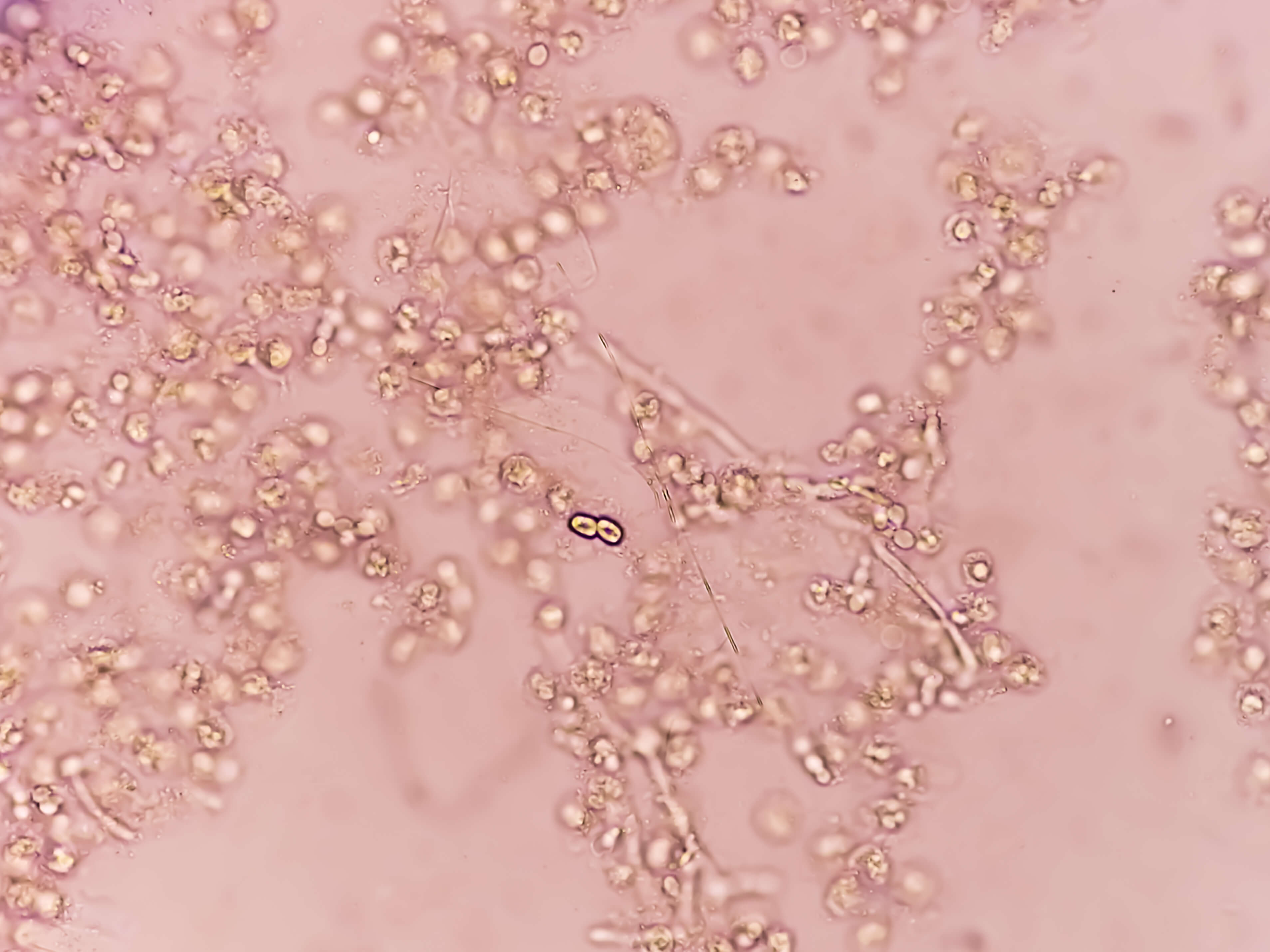 Candida albicans